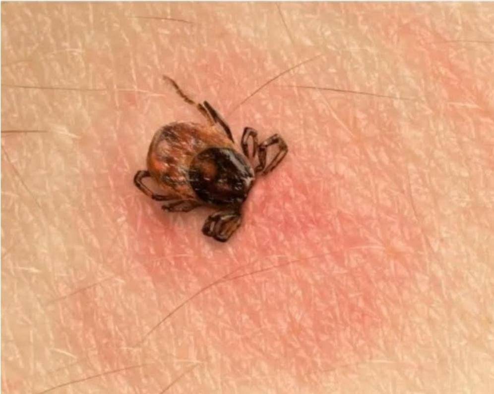 Slniečko, príroda ale aj... Ako sa účinne brániť voči Limskej borelióze?